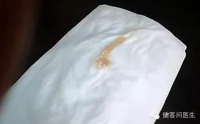 胡桃尿道口流出白色脓状物是什么?用户评论称可能是感染,建议及时就医! 胡桃尿道口流出白色脓状物是什么?用户评论称可能是感染,建议及时就医!
