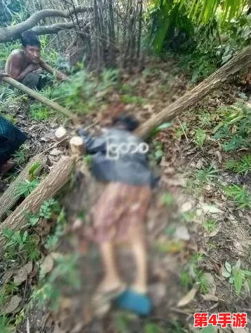 缅甸3分19秒砍断人手断人脚，勇敢面对困境，展现了生命的坚韧与希望